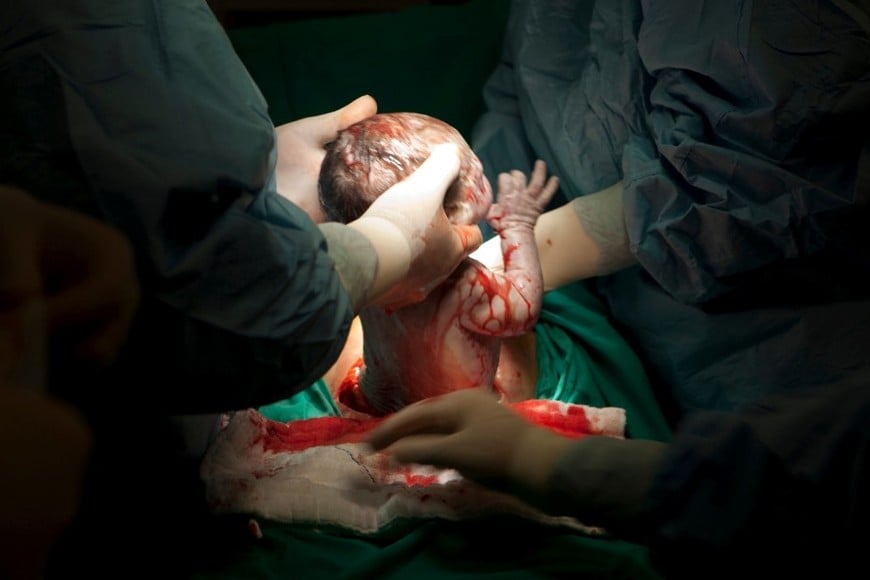 Casi dos de cada tres nacimientos se concretarón por cesárea