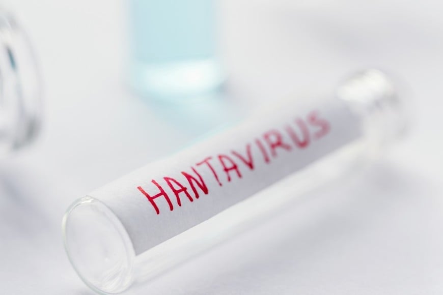 Las pruebas de laboratorio confirmaron la causa de la infección.