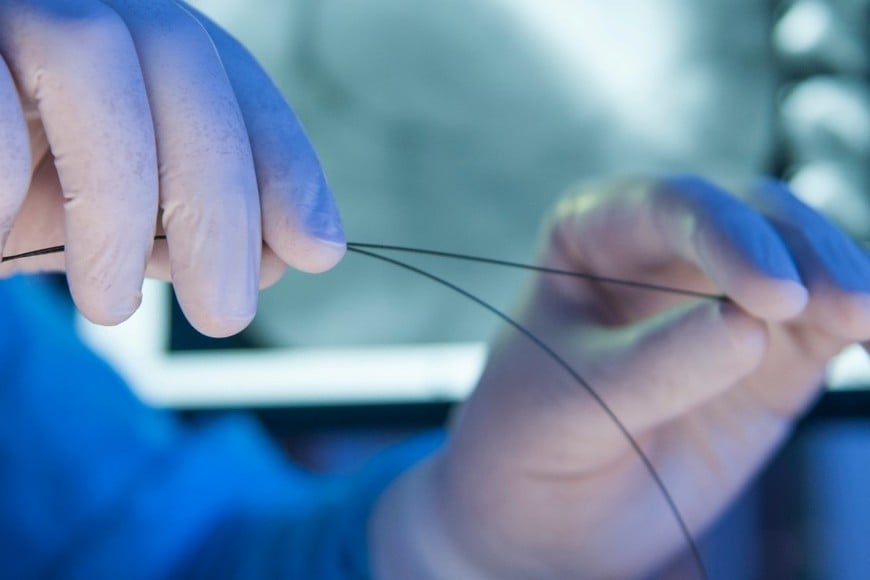 Se prohibió el uso y la comercialización de un stent carotídeo robado