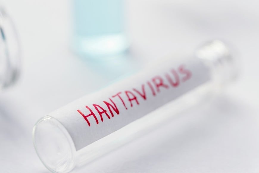 Su caso fue validado a partir de los registros del Sistema Integrado de Información Sanitaria Argentino (SISA)