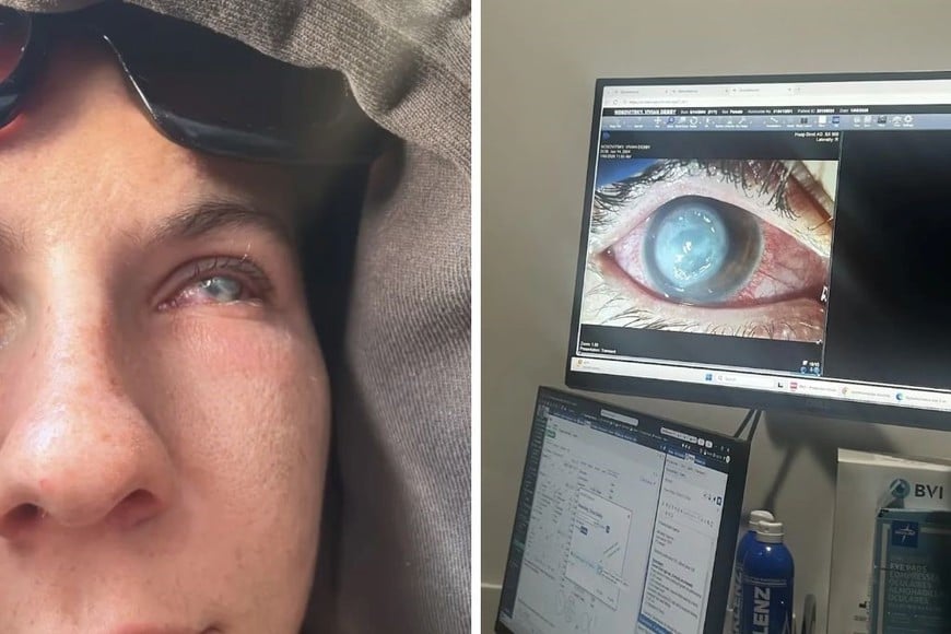 De una molestia a una pesadilla: el diagnóstico que le cambió la vida a una joven influencer.