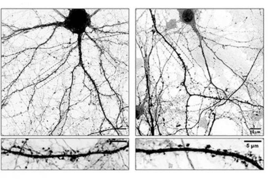 Izqu neuronas normales. Der: neuronas modificadas con L-Dopa.