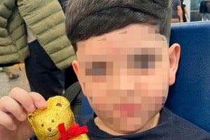 El menor sigue internado en Unidad de Terapia Intensiva.