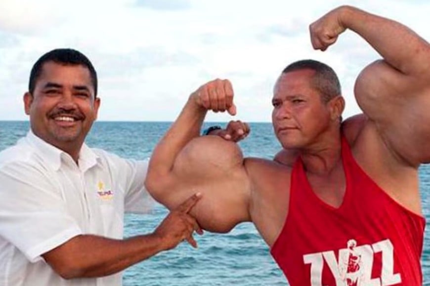 Su notoriedad se remonta a la década de 2000, cuando participó en programas de televisión