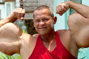 Arlindo de Souza, conocido en Brasil como el “Popeye brasileño”