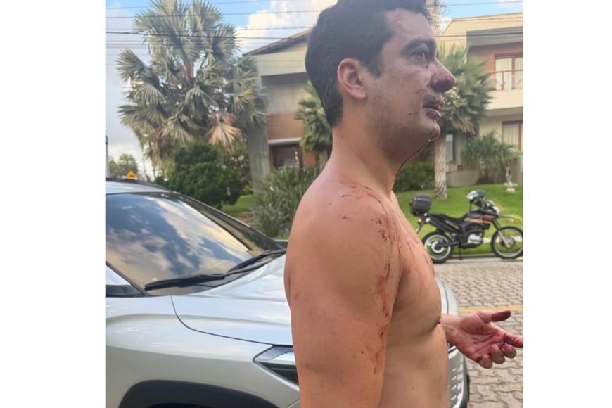 El enfrentamiento ocurrió en un barrio privado de Eusébio.