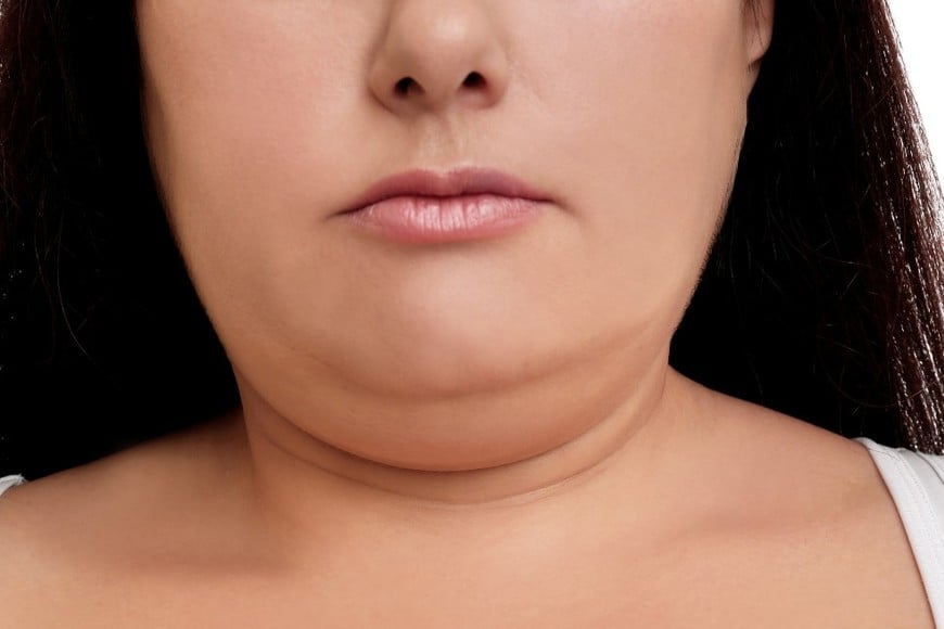 Hinchazón o sensación de rostro “lleno”.