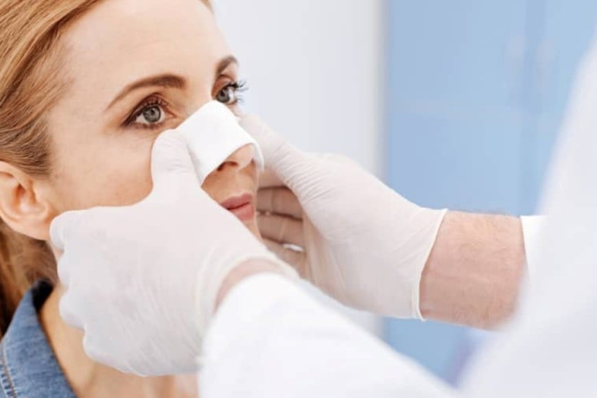 “Yeso Nasal Termo Moldeable – AQUAPLAST”