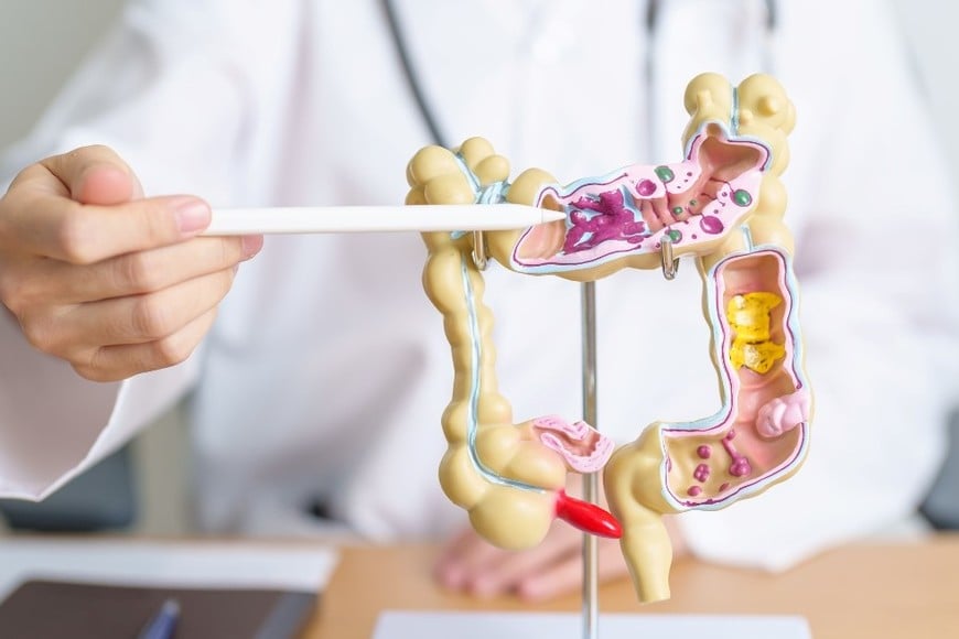 El cáncer de colon se detectan alrededor de 15.800 casos anuales