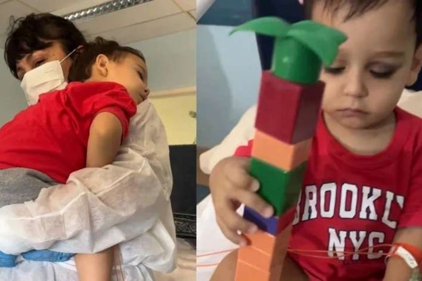 Felipe presentó mejorías e inicia quimioterapia en Florianópolis.