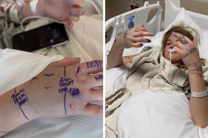 La víctima terminó en terapia intensiva y los médicos le administraron más de 70 dosis de antiveneno para estabilizarla.