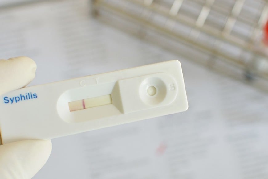 La sífilis en la población general continúa siendo un desafío