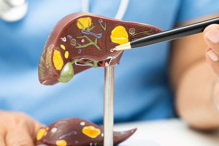 La hepatitis A tuvo un aumento del 600%.