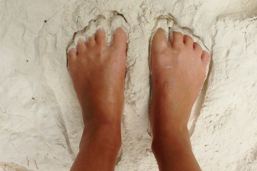 La prevención pasa por evitar caminar descalzo y el contacto directo con el suelo.
