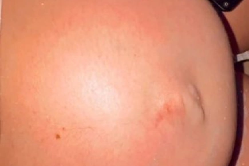 “Todo me asusta de la cesárea", había dicho Juanita días atrás.