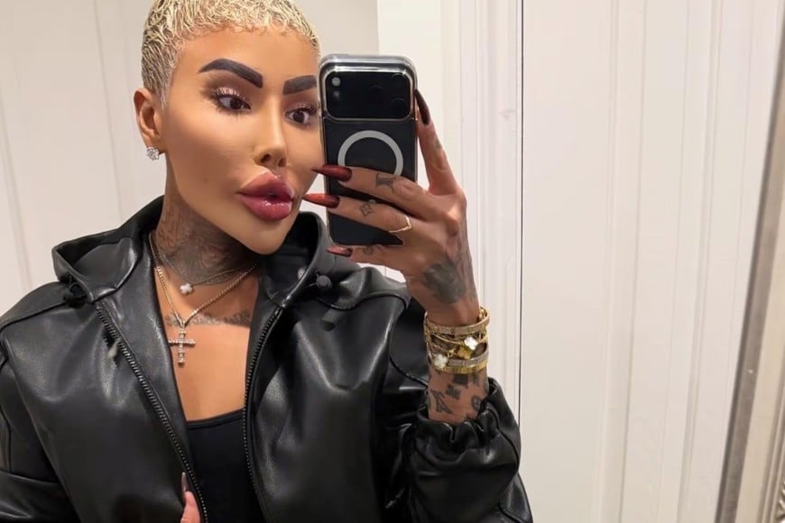 Las autoridades no descartan que esté relacionado con un procedimiento cosmético reciente.