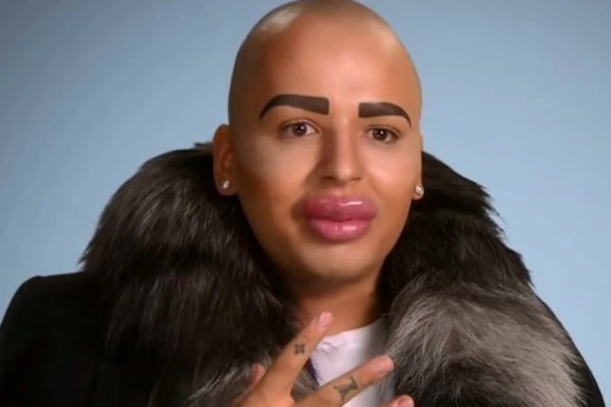 Antes de su muerte, apareció dos veces en Botched , de E!.