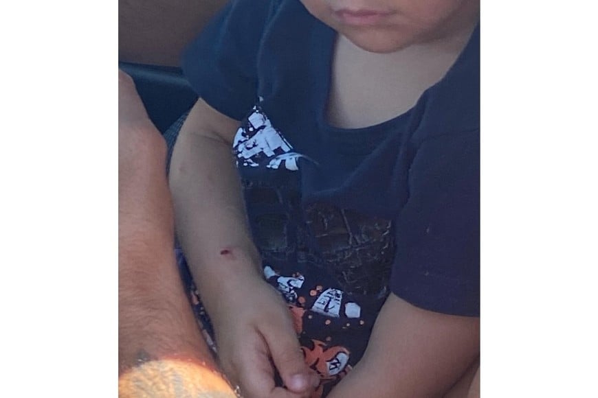 El niño fue atacado mientras caminaba con su abuela.