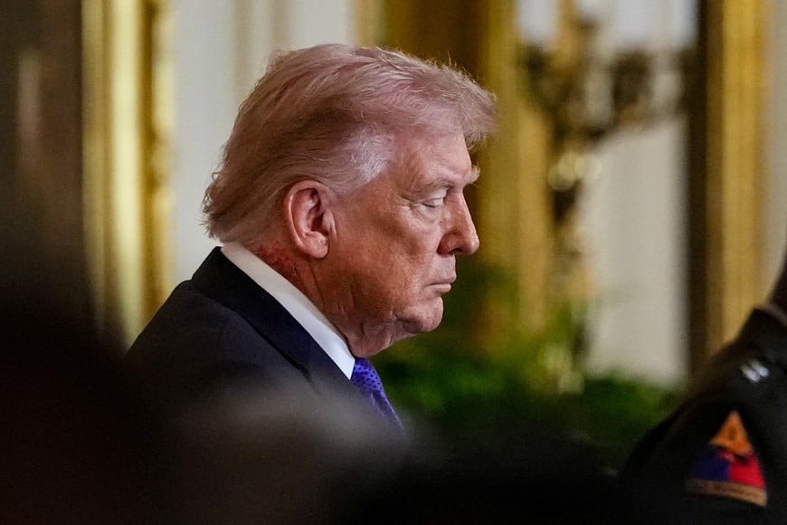 U.S. President Donald Trump looks on, as a patch of blemished skin is visible above his shirt collar, during  a Medal of Honor ceremony at the White House in Washington, D.C., U.S., March 2, 2026. REUTERS/Ken Cedeno