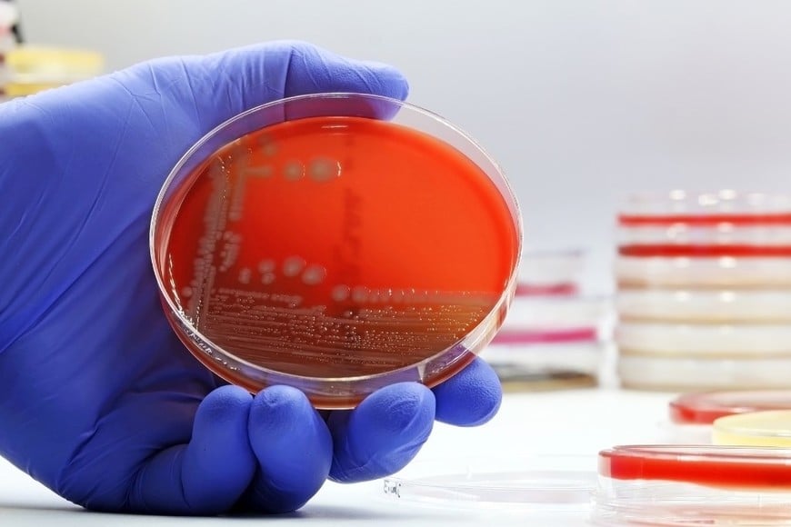 Salta confirmó ocho casos de meningitis y meningoencefalitis.