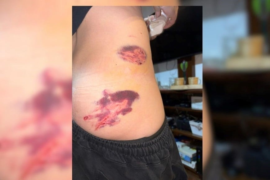 Las lesiones en el operario de la EPE atacado por perros. Foto: Gentileza