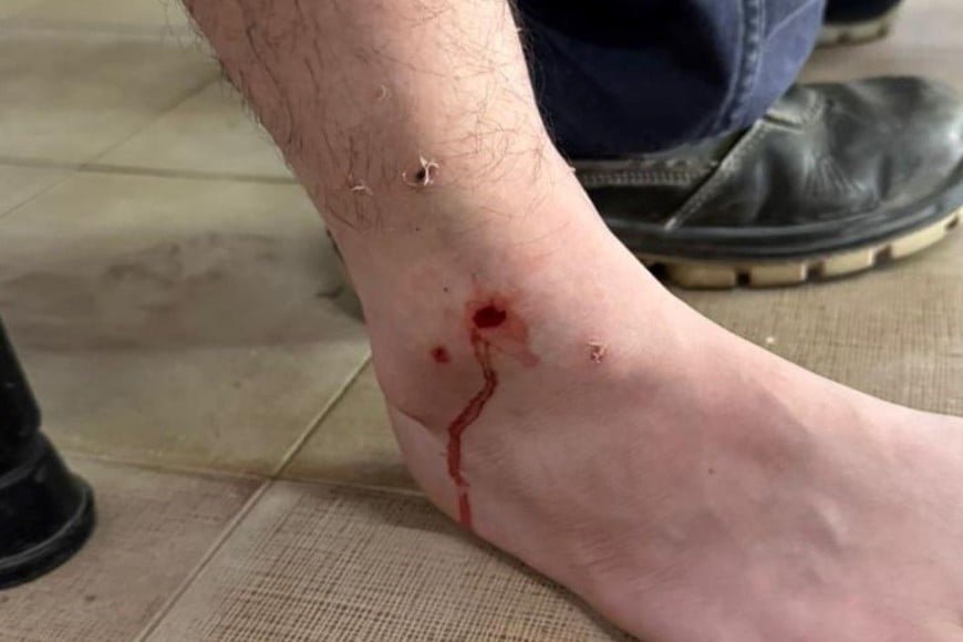 Las lesiones en el operario de la EPE atacado por perros. Foto: Gentileza