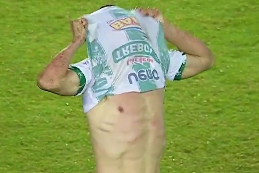 El protagonista de una secuencia insólita.