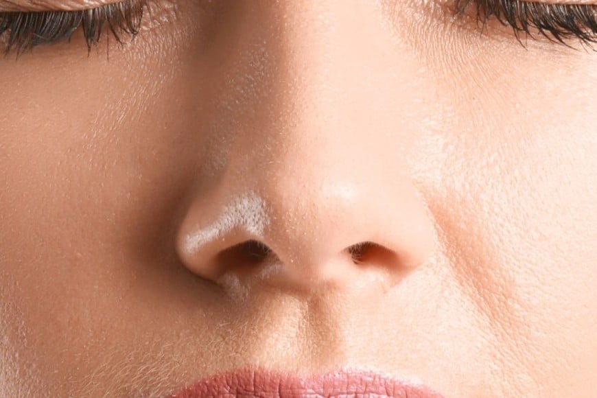 La nariz tapada se origina, en la mayoría de los casos, por la inflamación de la mucosa nasal.