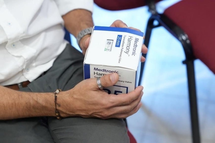 Primer implante de válvula pulmonar percutánea Harmony