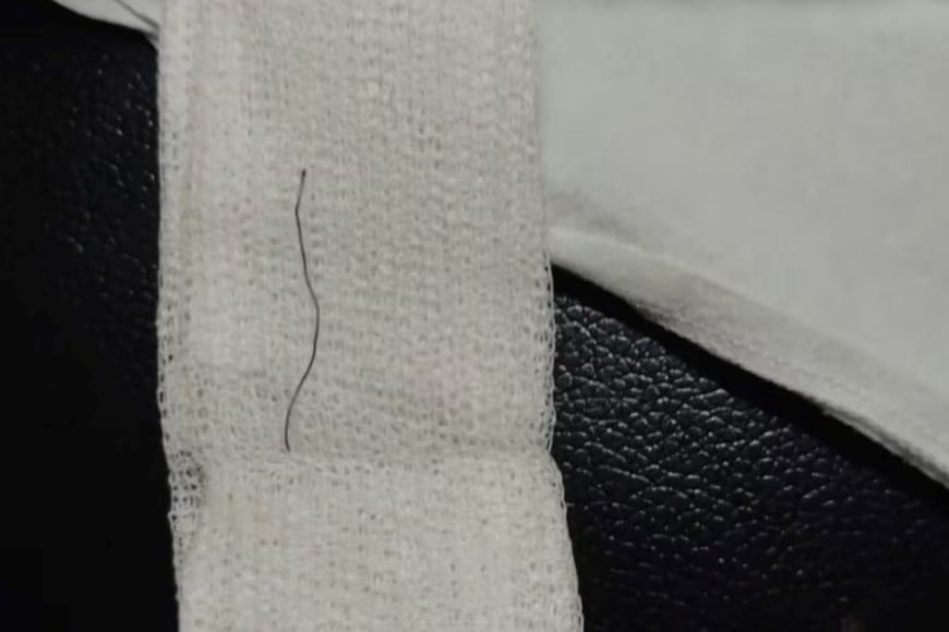 El alambre encontrado en la garganta