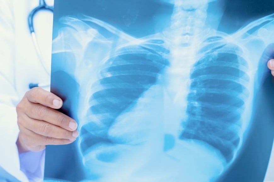 El caso fue detectado en un alumno de sexto año