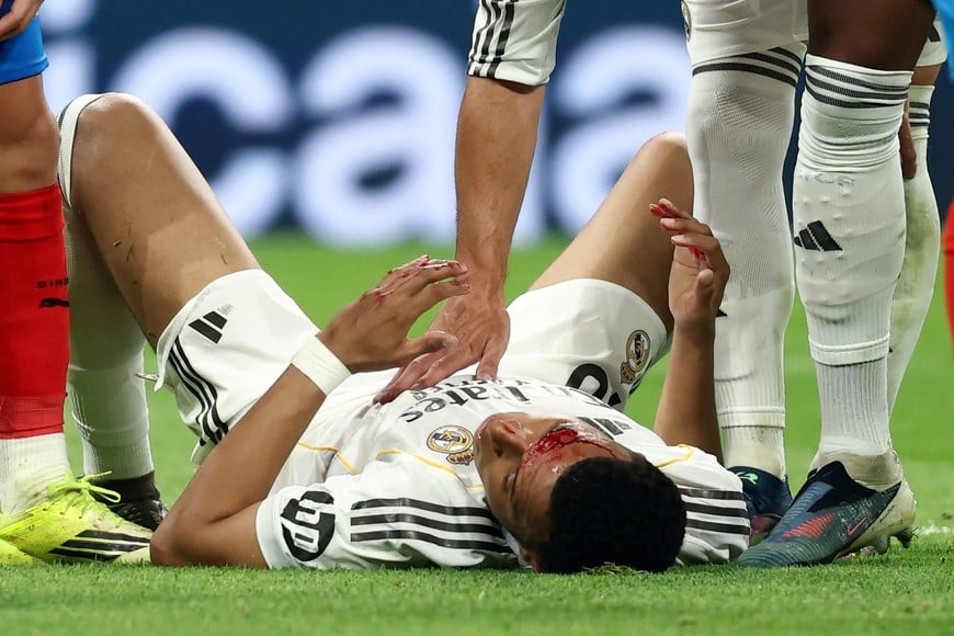 Soccer Football - LaLiga - Real Madrid v Girona - Santiago Bernabeu, Madrid, Spain - April 10, 2026
Real Madrid's Kylian Mbappe reacts after sustaining an injury REUTERS/Gonzalo Fuentes