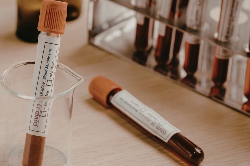 El caso remite a grupos sanguíneos de muy baja prevalencia