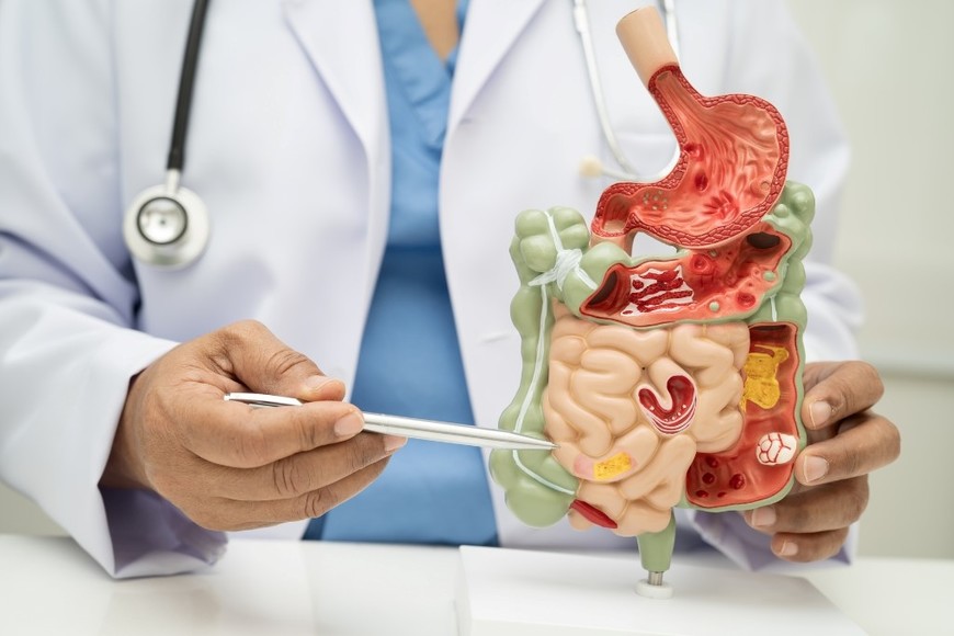 El intestino cumple un rol clave en la salud general.