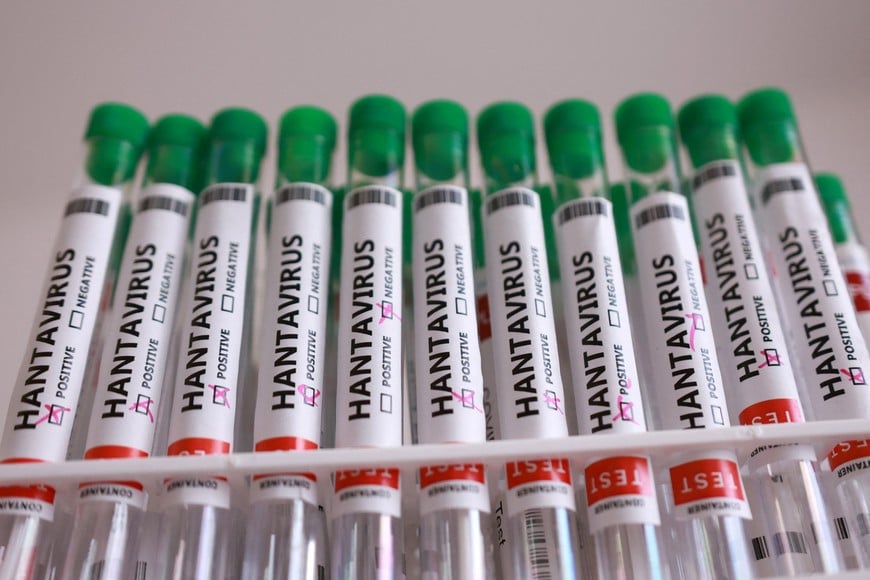 Test tubes labelled "Hantavirus positive" in this illustration taken May 7, 2026. REUTERS/Dado Ruvic/Illustration