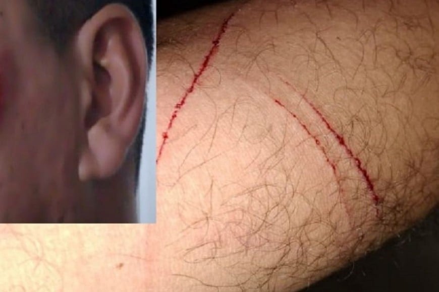 policías heridos destornillador