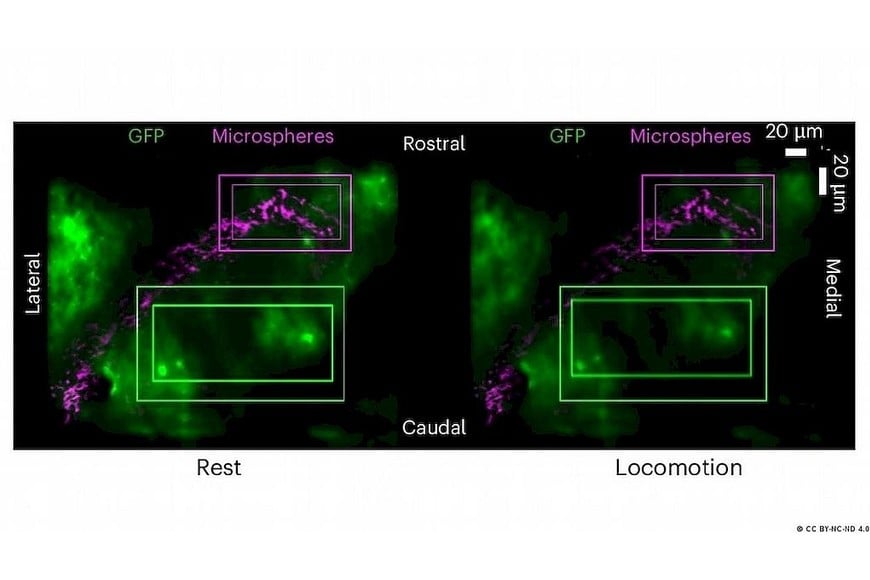 Imágenes del cerebro durante reposo y movimiento muestran un ligero desplazamiento cerebral mientras el cráneo permanece en la misma posición.