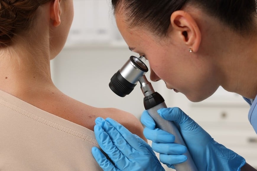 Es fundamental realizar controles dermatológicos anuales