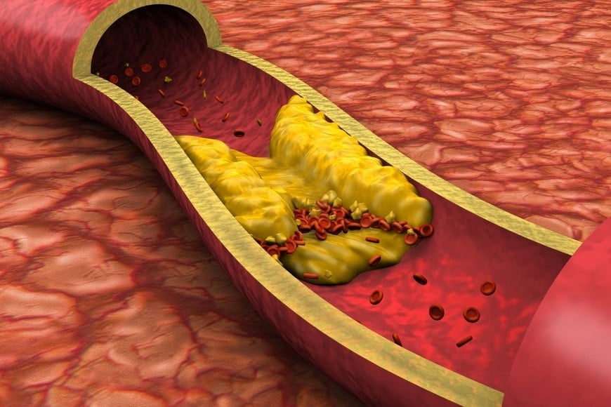 El colesterol es una grasa que el cuerpo necesita para funcionar. Participa en la formación de hormonas, vitaminas y membranas celulares.