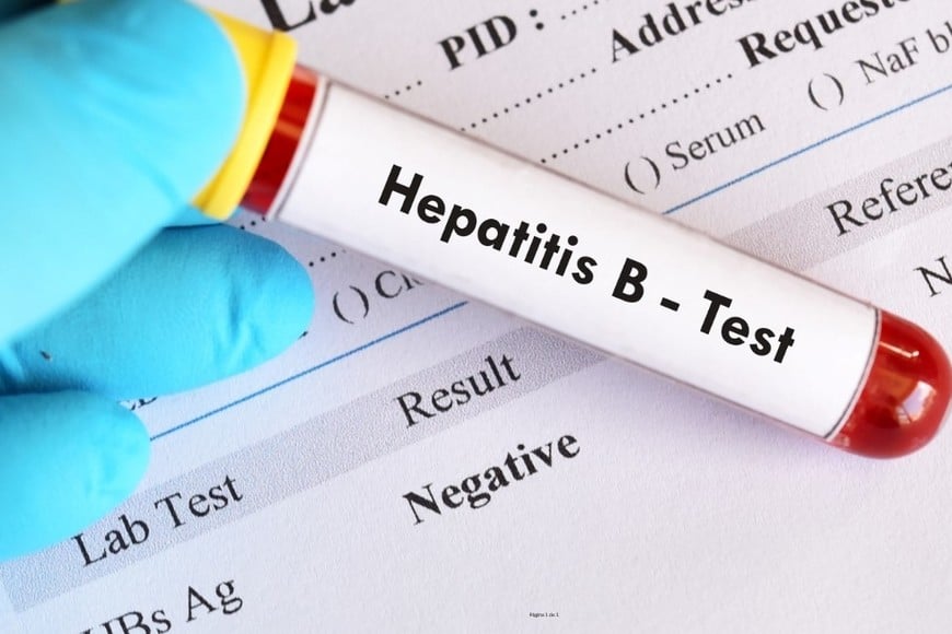 La hepatitis B es una infección viral que afecta al hígado y puede transmitirse a través de sangre