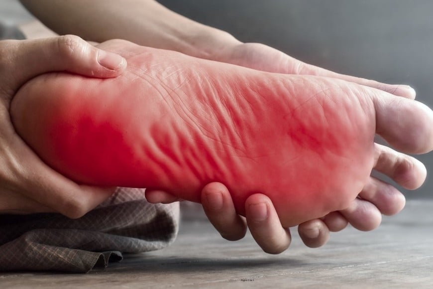 Existen varios factores que aumentan el riesgo de desarrollar fascitis plantar.