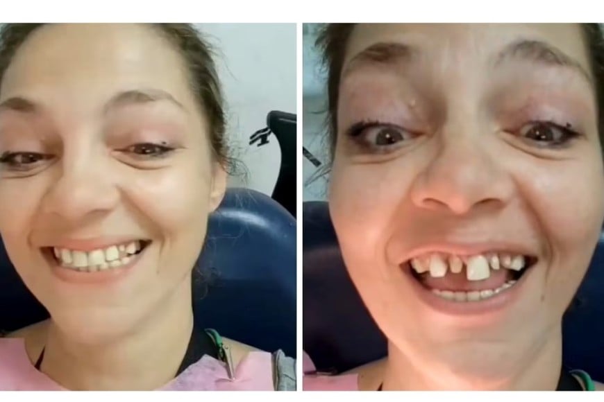 El día que Tamara Paganini mostró cómo le estaban arreglando la dentadura.