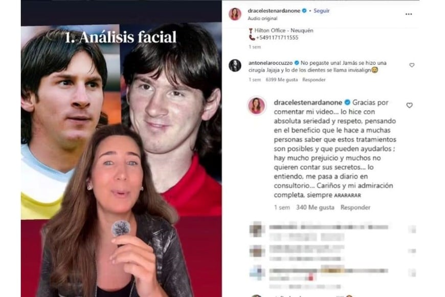 messi cirugías
