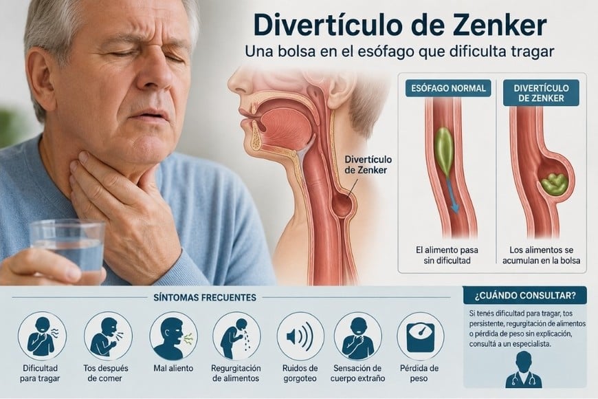 Esta enfermedad suele pasar desapercibida durante mucho tiempo