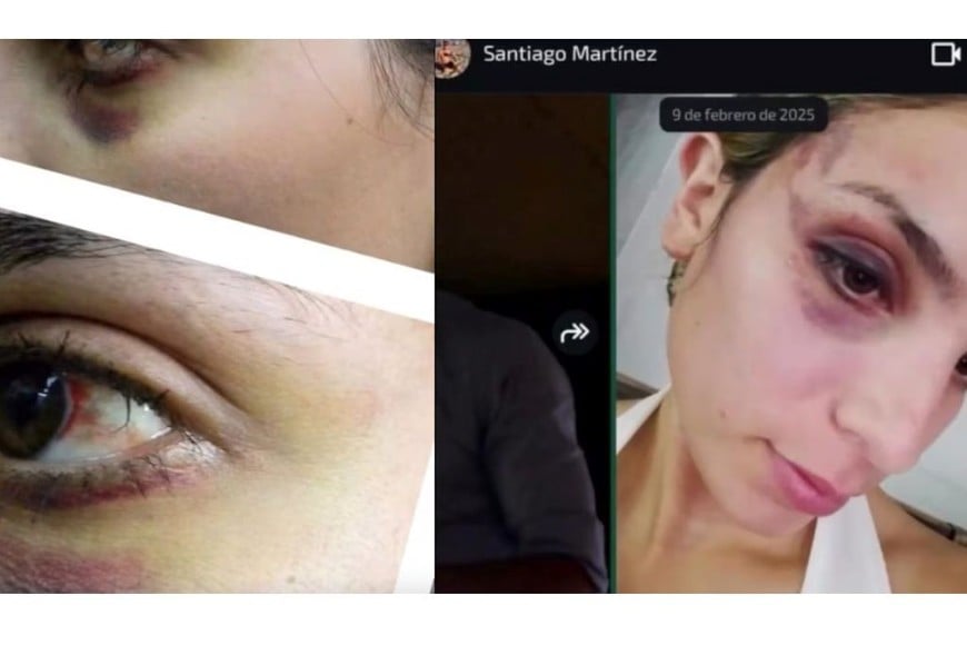 Emily Ceco denunció a Santiago Martínez en febrero de 2025 tras escapar de la casa que compartían en General Rodríguez.