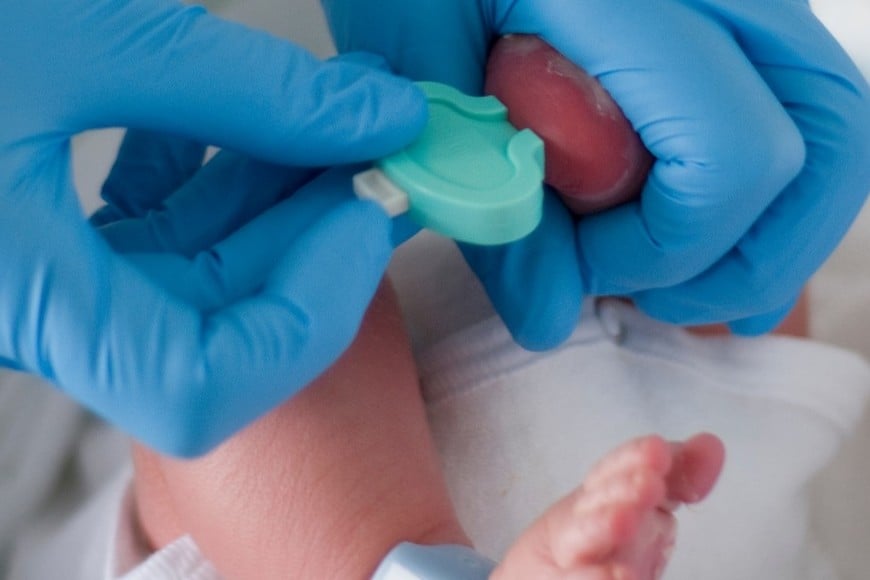 Pesquisa neonatal, también conocida como “prueba del talón