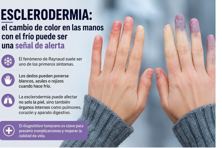 Para tene encuenta y consultar