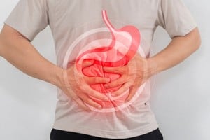 La gastritis es la inflamación del revestimiento interno del estómago