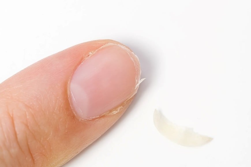 Las dietas muy restrictivas o pobres en proteínas pueden repercutir en el crecimiento de uñas más débiles y finas.