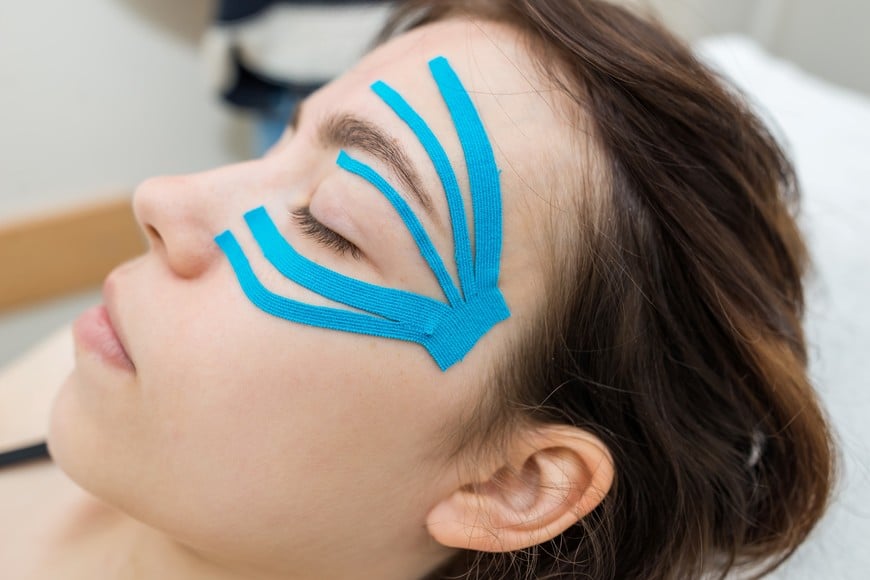 La técnica promete cambios temporales en la apariencia facial.